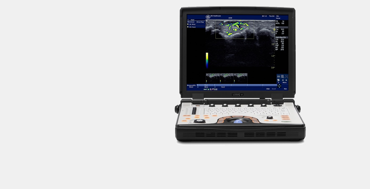 New-LOGIQ-e-Ultrasound-Main-Image_080615